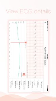 Chero ECG screenshot 4