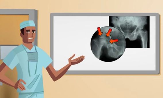 Hip Surgery screenshot 2