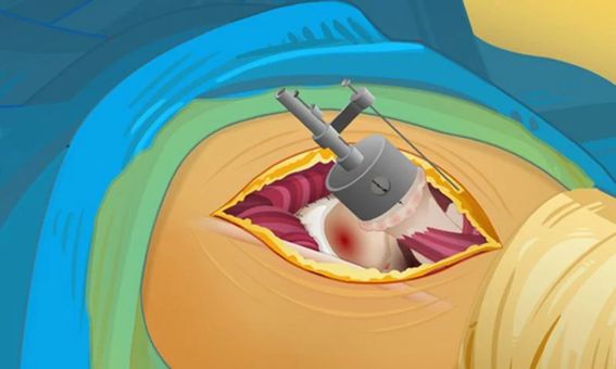 Hip Surgery screenshot 4