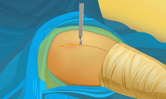 Hip Surgery screenshot 3