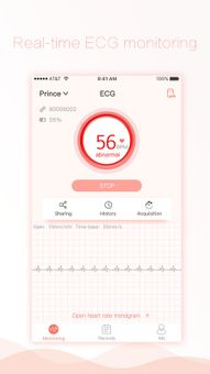 Chero ECG screenshot 2