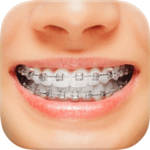 Braces APK